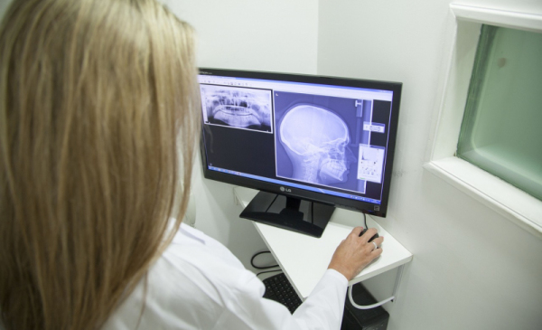 Na zdjęciu: lekarka patrzy na monitor, na którym wyświetlane jest zdjęcie RTG czaszki